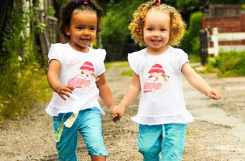  “Dark-Skinned And White-Skinned Twins”: The Sisters Are Now Already 13 Years Old!