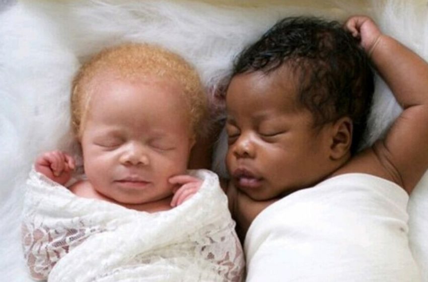  “Such Unusual Twins”: The Babies Grew Up And Mom Made a Very Beautiful Photo Shoot!