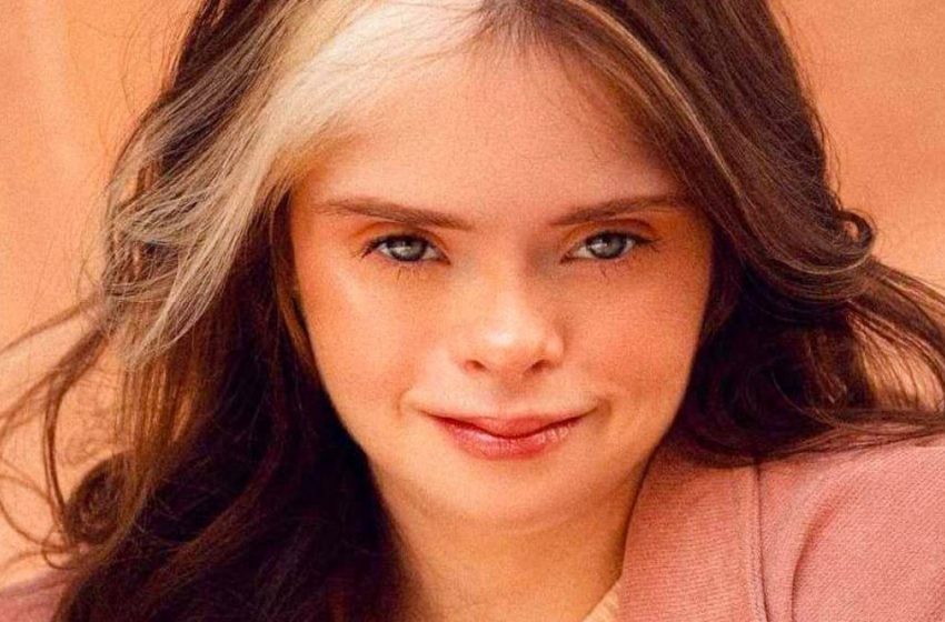  Success Story Of a Model With Down’s Syndrome: Young Girl’s Photoshoot Inspires Others!