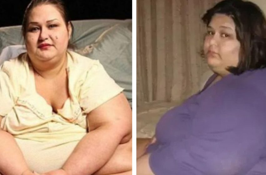 A woman who weighed almost 500 Ibs changed after an accident