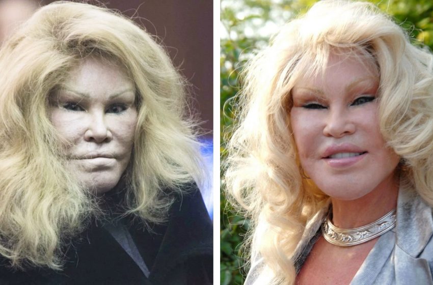  “Used to be such a beauty”: how the famous plastic surgery aficionado looked before her countless surgeries