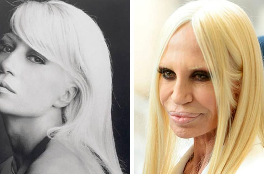  Why would they do that? Celebrities who have severely damaged their looks over time with plastic surgery