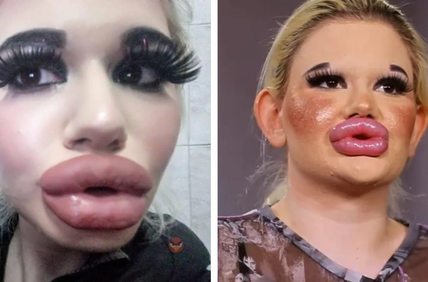  “Used to be a pretty girl”: how the 22-year-old Bulgarian looked before all the plastic surgeries