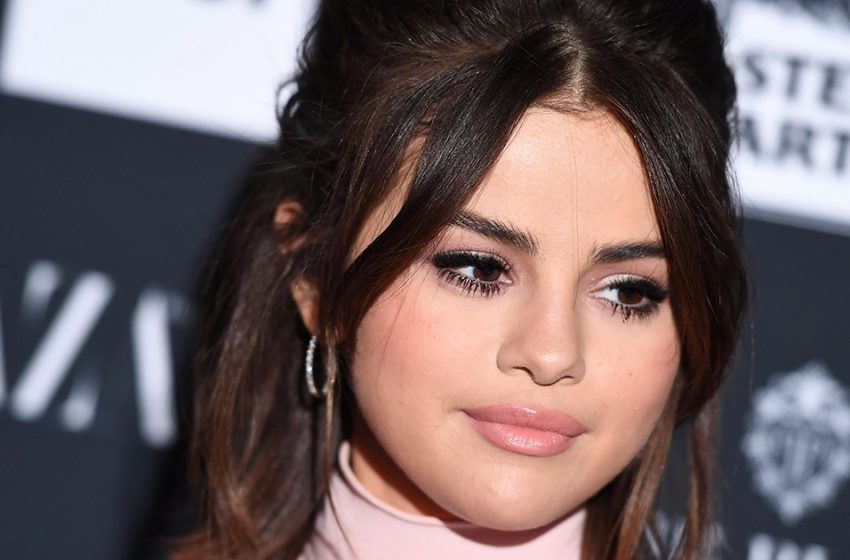  Selena Gomez shared an honest photo without makeup and photoshop and showed her skin flaws