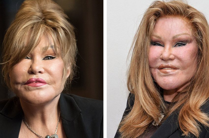  What the celebrity plastic surgery aficionado looked like before her countless surgeries