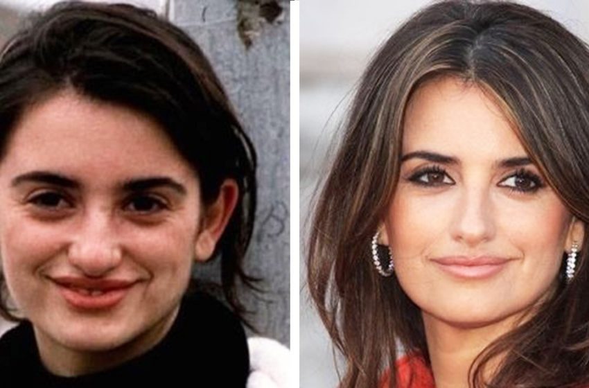  ‘Age or rhinoplasty’: 10 celebrities who became much more attractive after nose reshaping