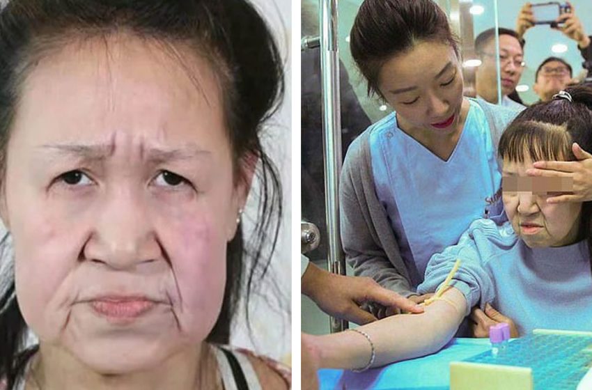  How was the life of Xiao Feng, a Chinese woman who had the appearance of an old woman in her 15s