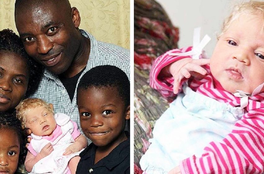  A dark-skinned couple have an albino daughter. What she looks like 10 years later