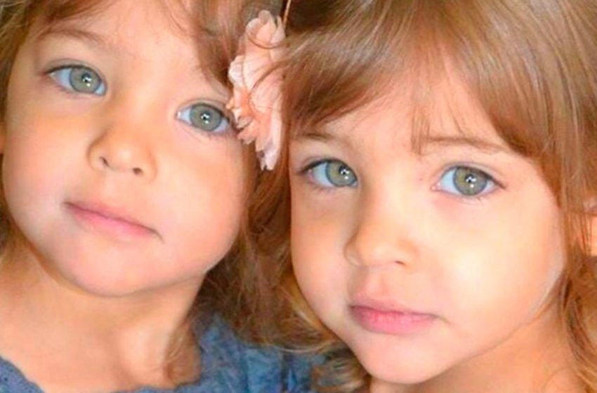 What have become the world’s most beautiful twins who have been famous since birth