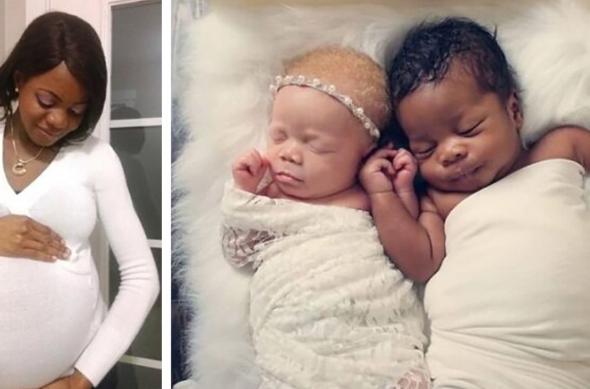  A Canadian woman gave birth to adorable twins with different skin colours. What the boys look like today