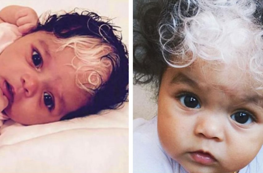  This little girl was born with a white strand of hair. She surprised everyone but her mum….