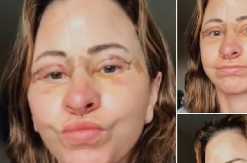 Femeie cheltuie 14.000 de dolari pe un lifting facial, își vinde casa și adoptă viața în rulotă după o transformare uluitoare!