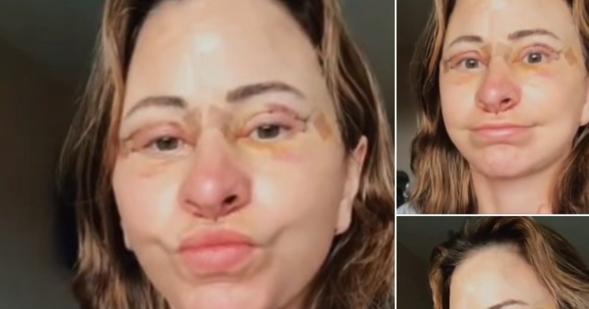 Femeie cheltuie 14.000 de dolari pe un lifting facial, își vinde casa și adoptă viața în rulotă după o transformare uluitoare!