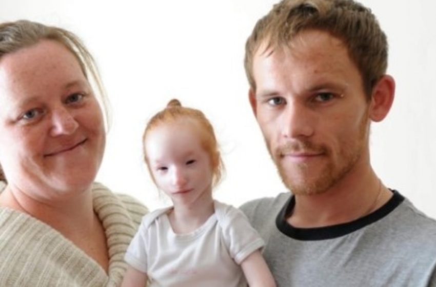  „Cântărea aproximativ 1 kg”: Cea mai mică fată din lume, Charlotte Garside, își sărbătorește cea de-a 16-a aniversare!